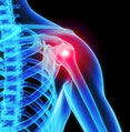 shoulder osteoarthritis
