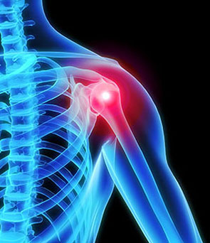 shoulder osteoarthritis